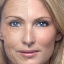 What women should know about wrinkles