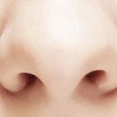 Nosebleeds – mostly harmless symptom of a strained nose