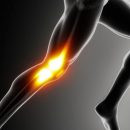 Knee pain can occur at any age