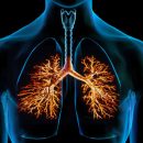 Acute bronchitis is one of the most common diseases