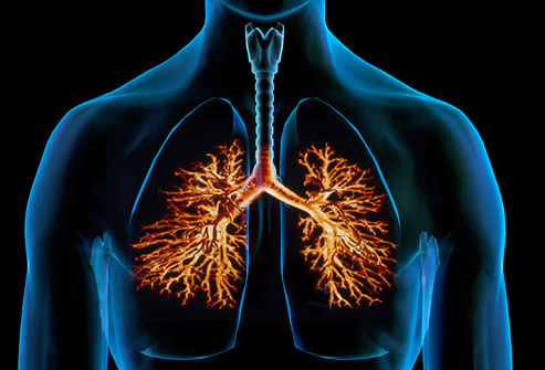 Acute bronchitis