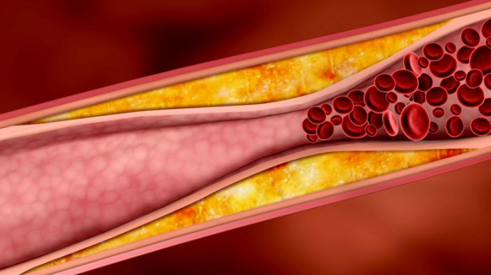 Cholesterol 