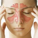 How nasal irrigation help with sinusitis?