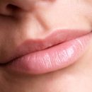 Long-term help for dry lips
