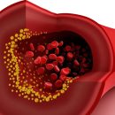 HDL Cholesterol: “The Good Cholesterol” but no heart protector?