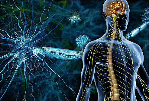 Multiple sclerosis may cause a disturbance of the blood vessels in the neck?